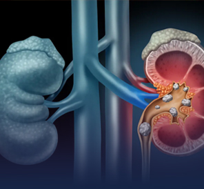 bobrek-ureter