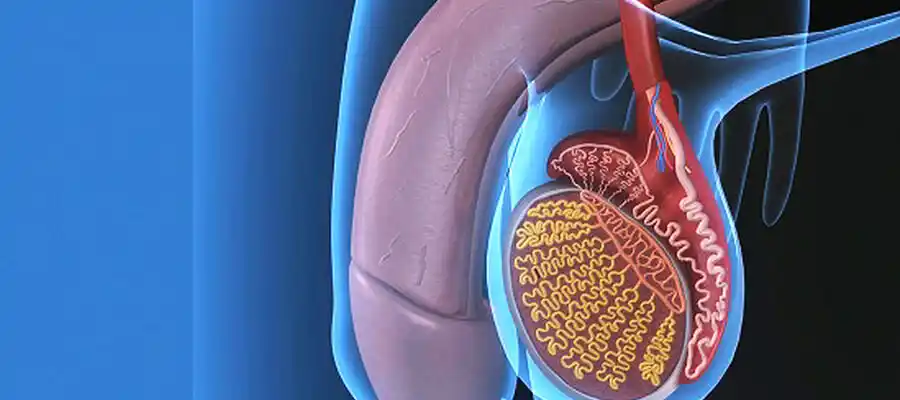 Varikosel Olan Biri Ne Yapmalı